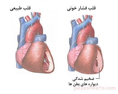 اطلاعاتی درباه فشار خون